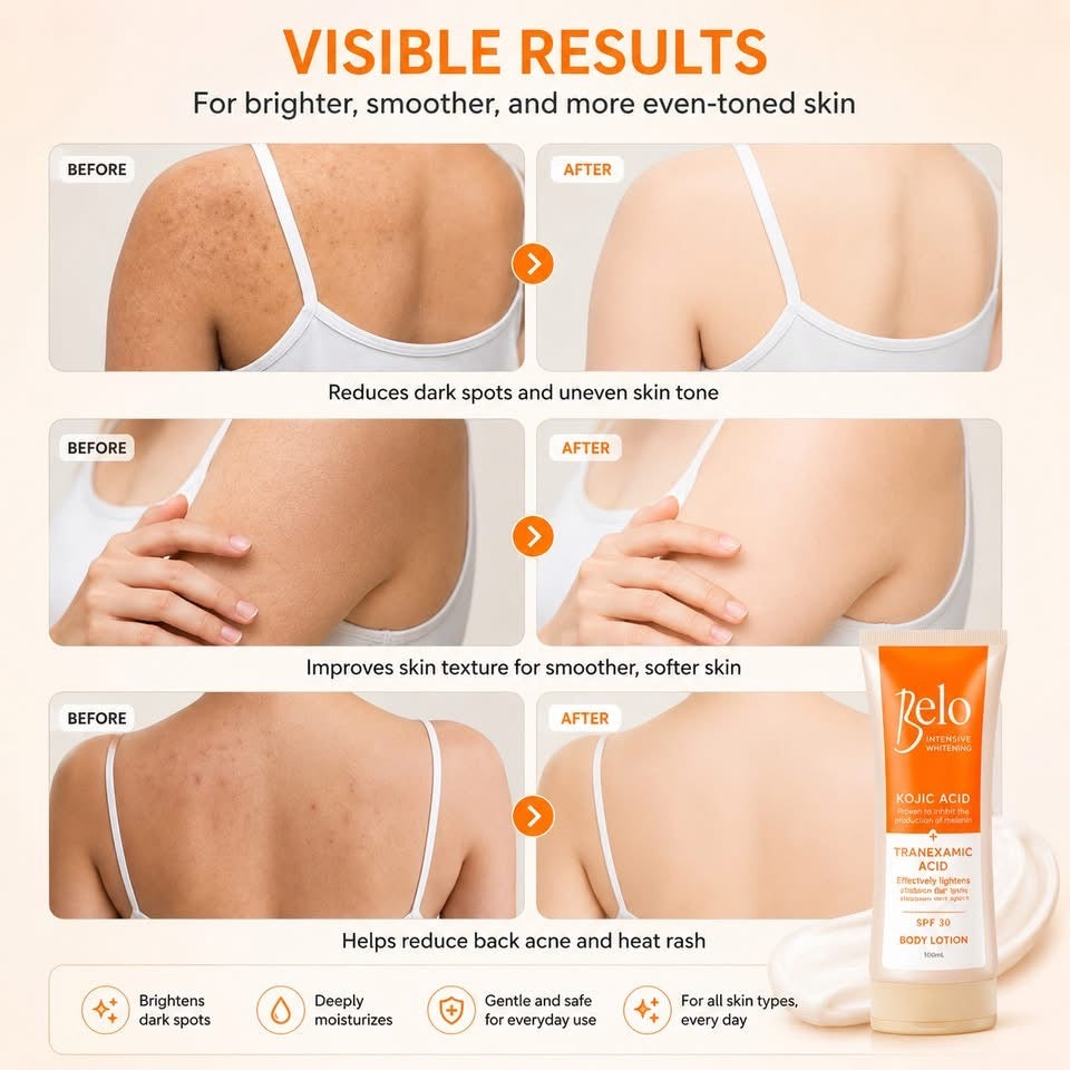 Belo Whitening Lotion