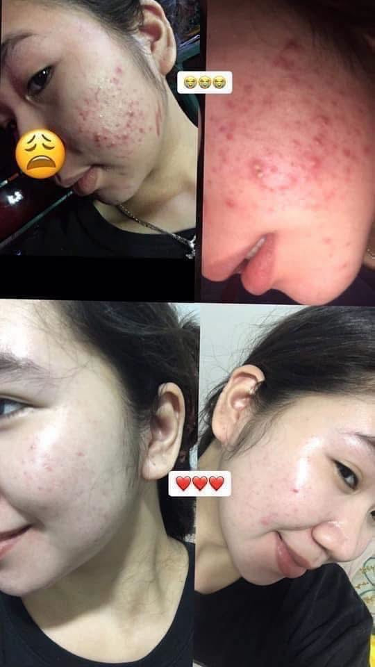 Brilliant Skin Essentials Rejuvenating Facial Set