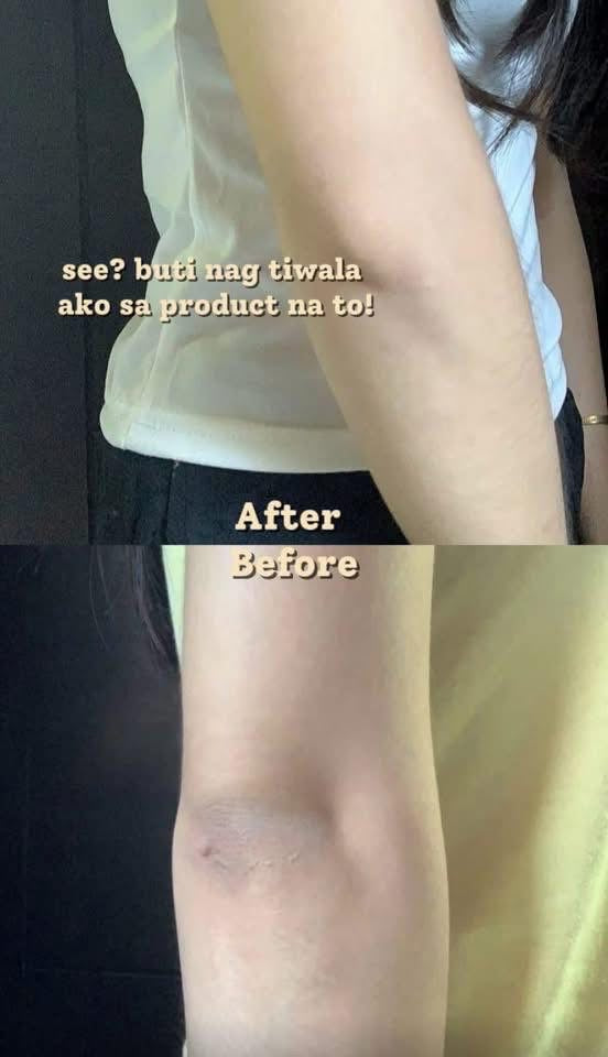 Cat and co under arm , elbow and knees Whitening serum