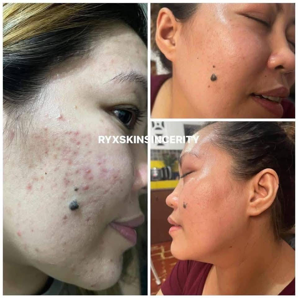 RyxSkin Double Cleanse Duo