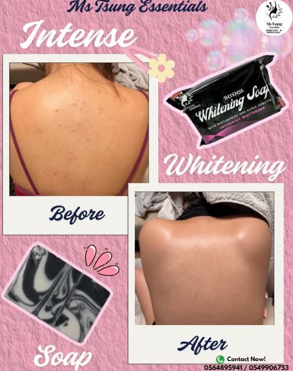 Ms Tsung Intense Whitening soap