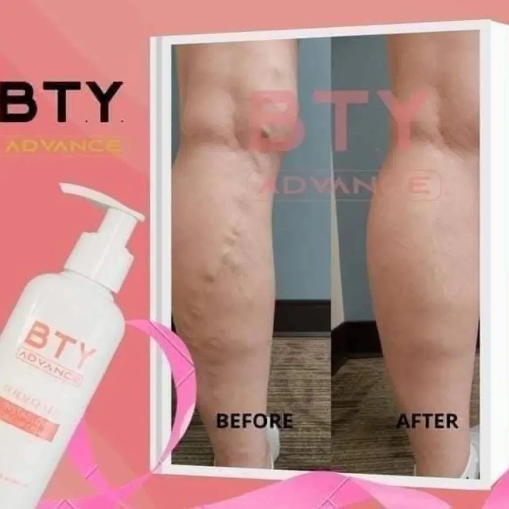 Bty lotion