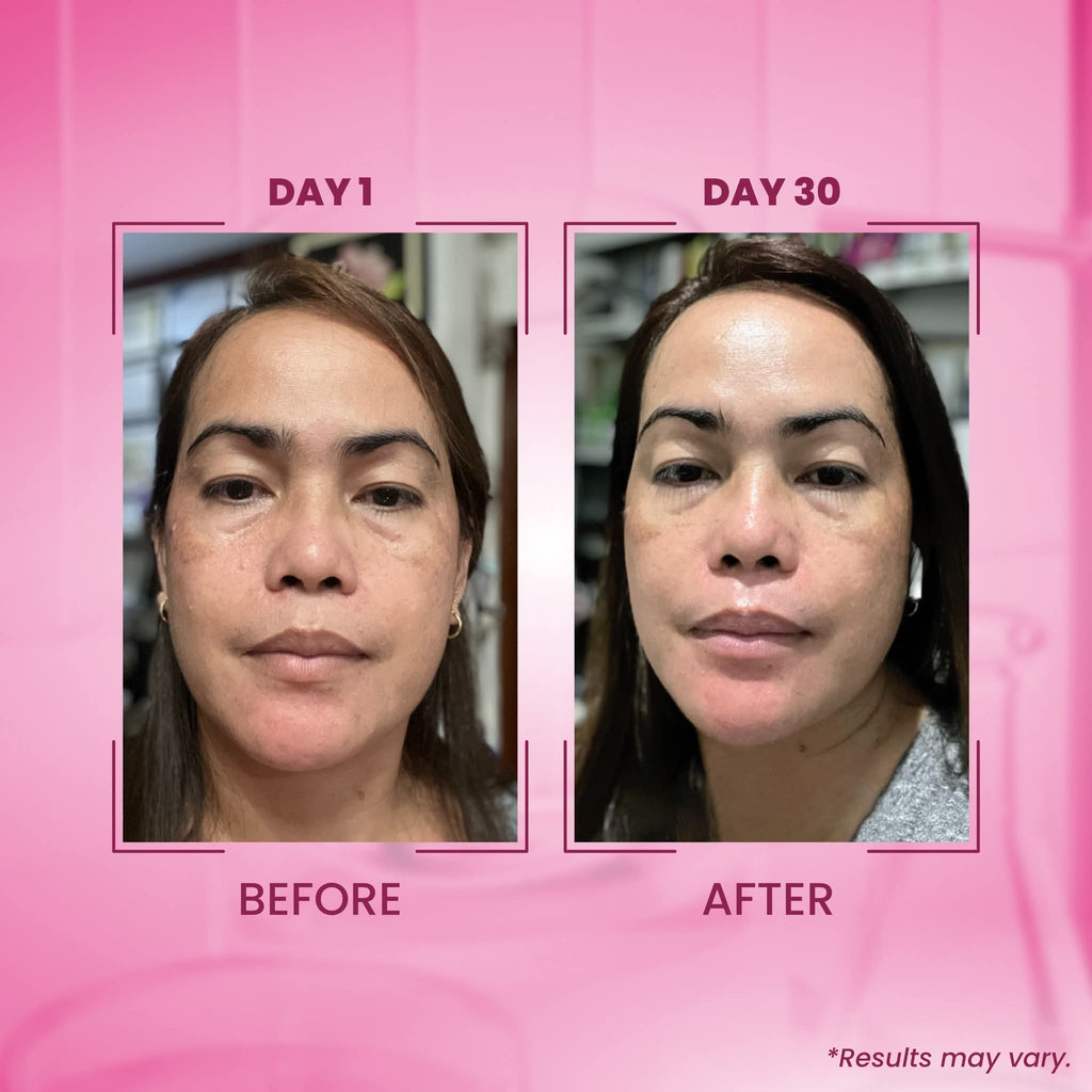 Txa melasma clear luxe organic