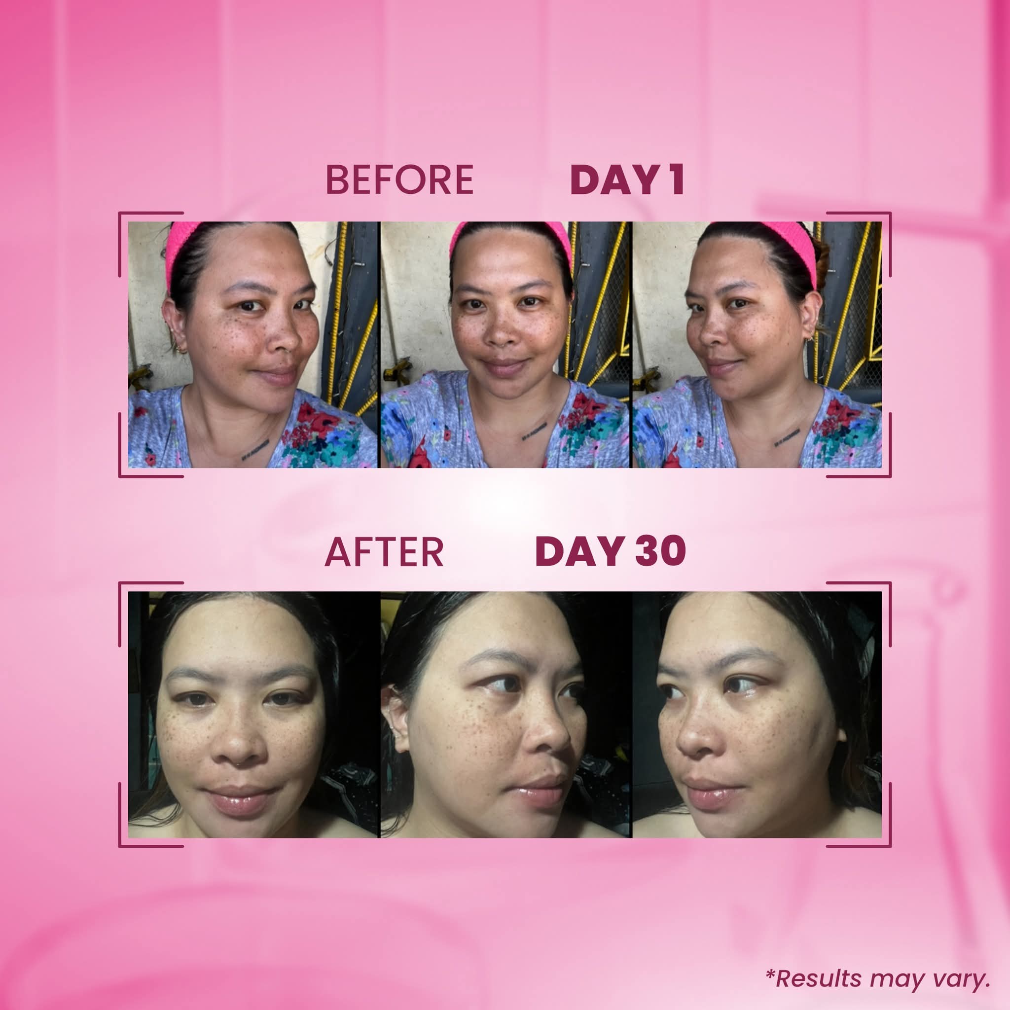 Txa melasma clear luxe organic
