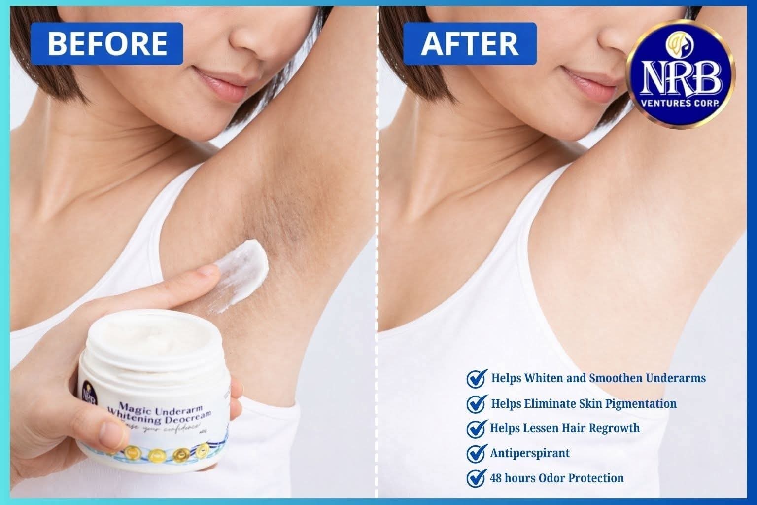 NRB Magic Underarm