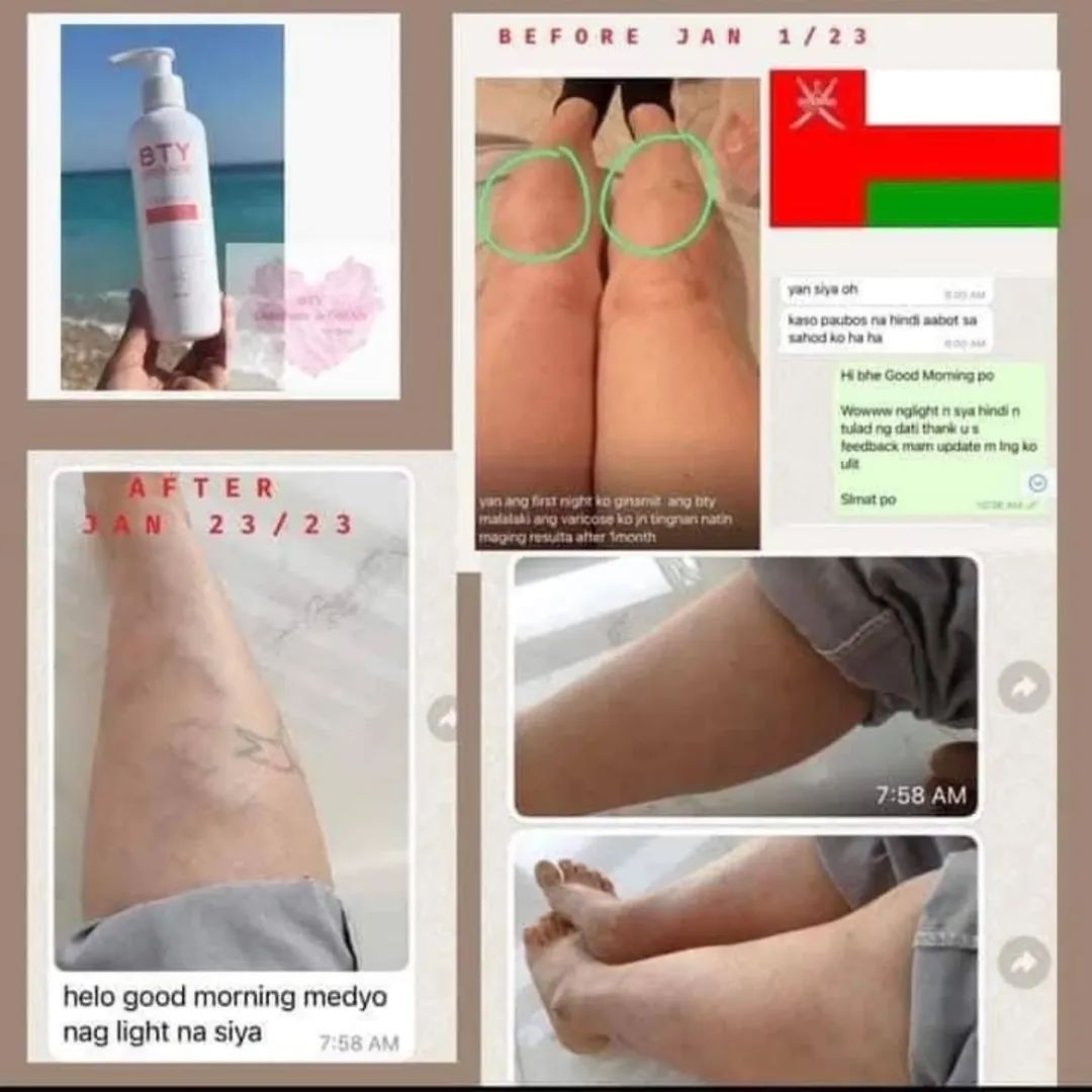 Bty lotion