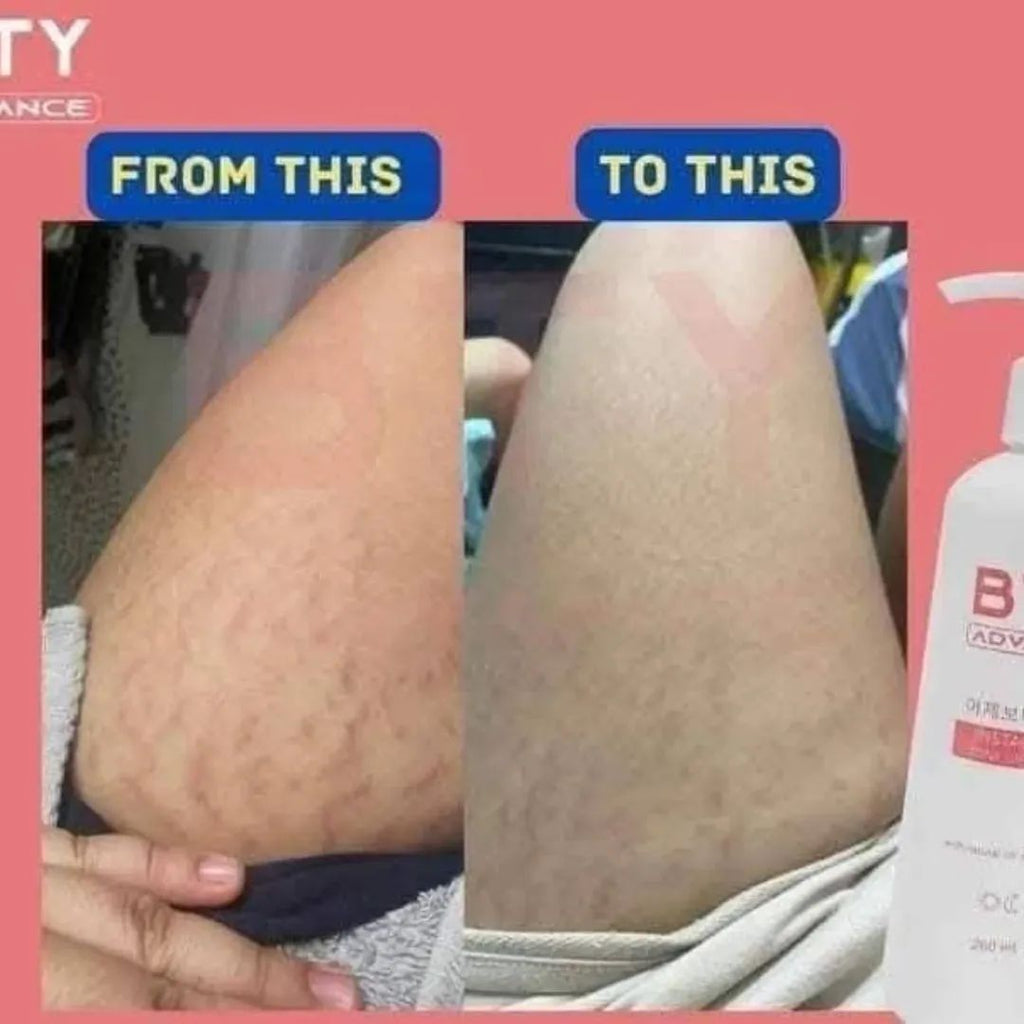 Bty lotion