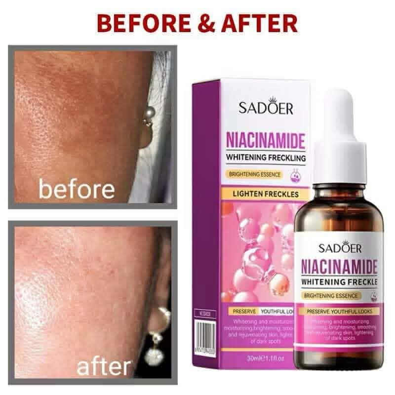 Sadoer Niacinamide Serum Whiten Anti-Freckle 30ml