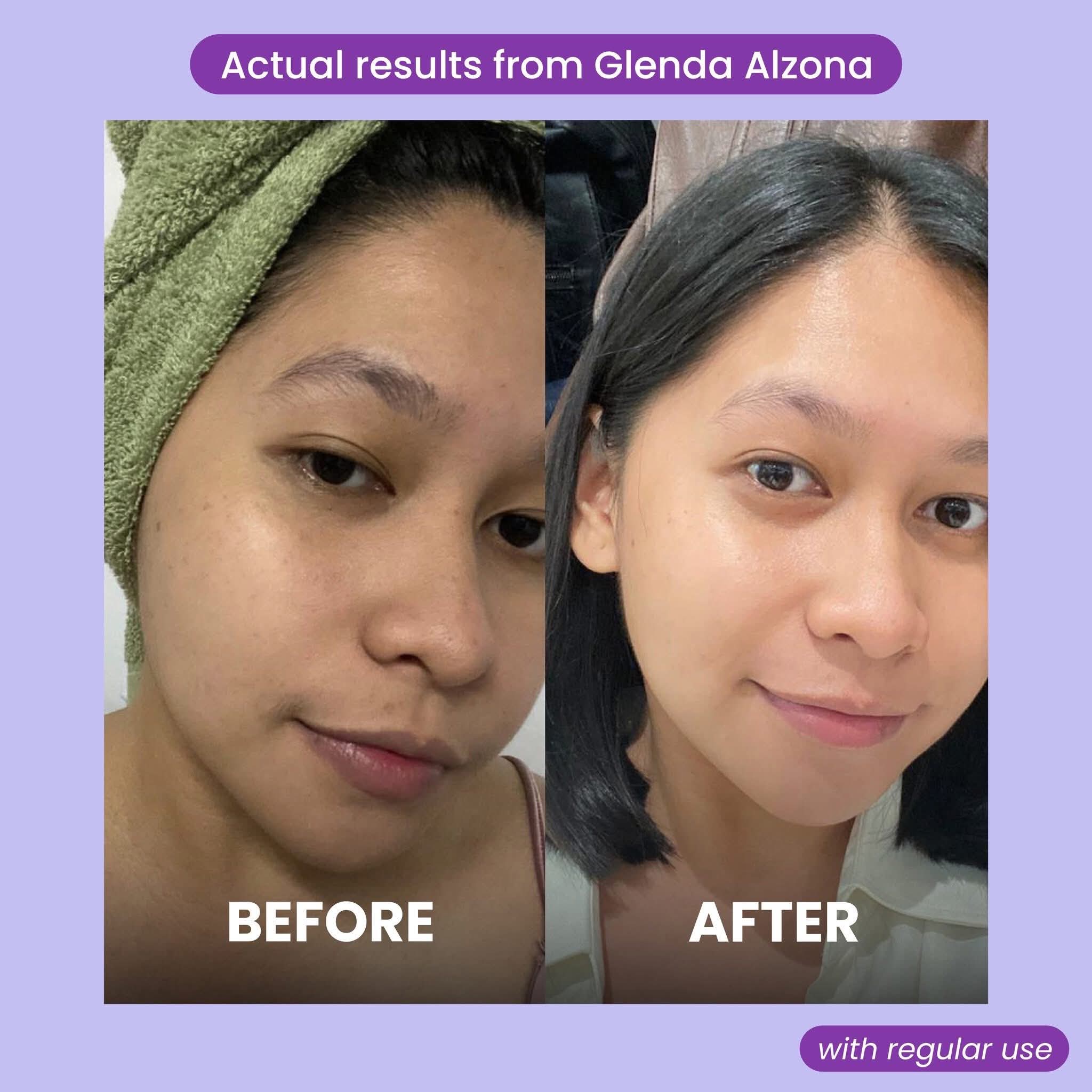 Retinol + Bakuchiol Deep Wrinkle Eye Contour Cream