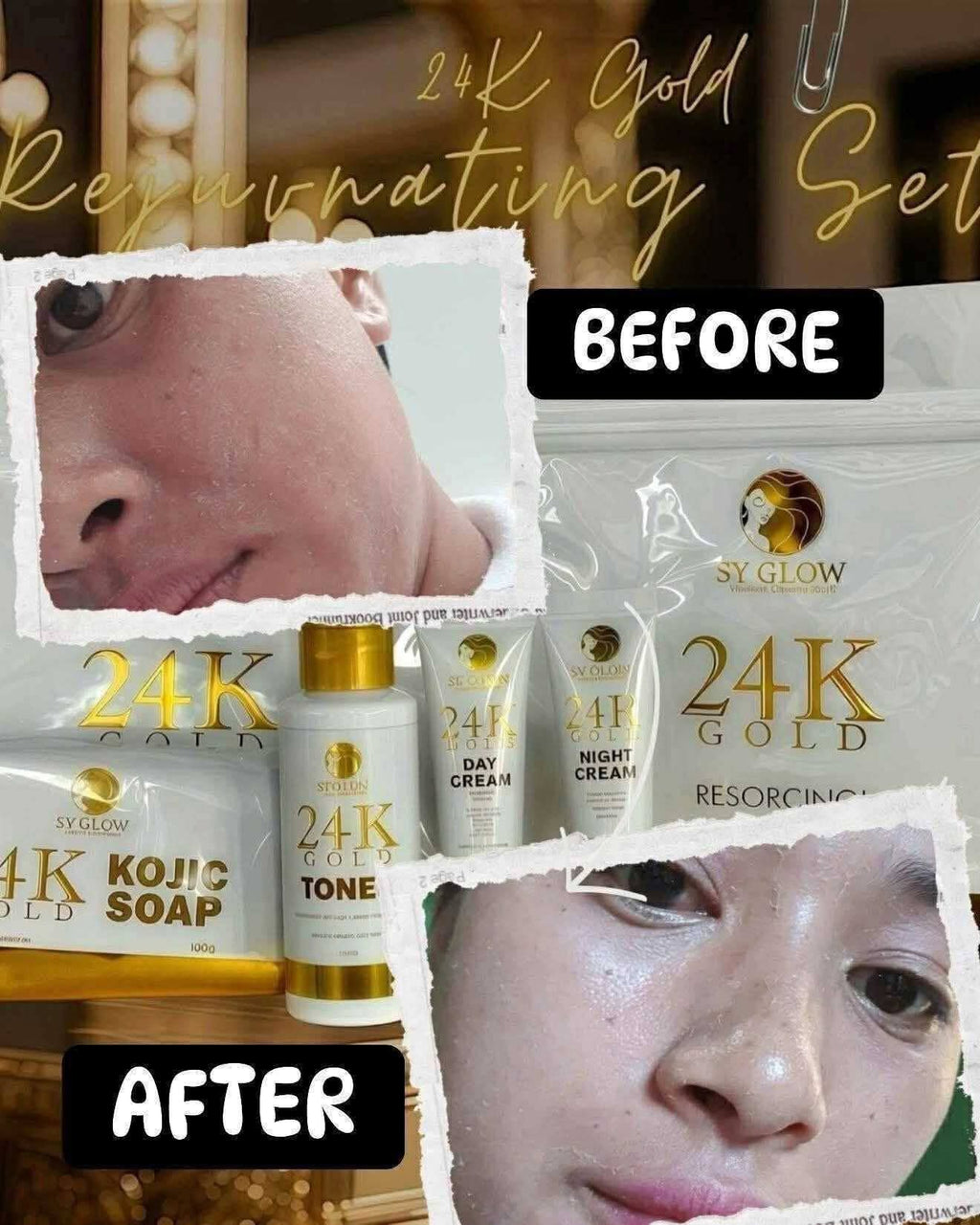 SY GLOW 24K GOLD RESORCINOL REJUVENATING SET