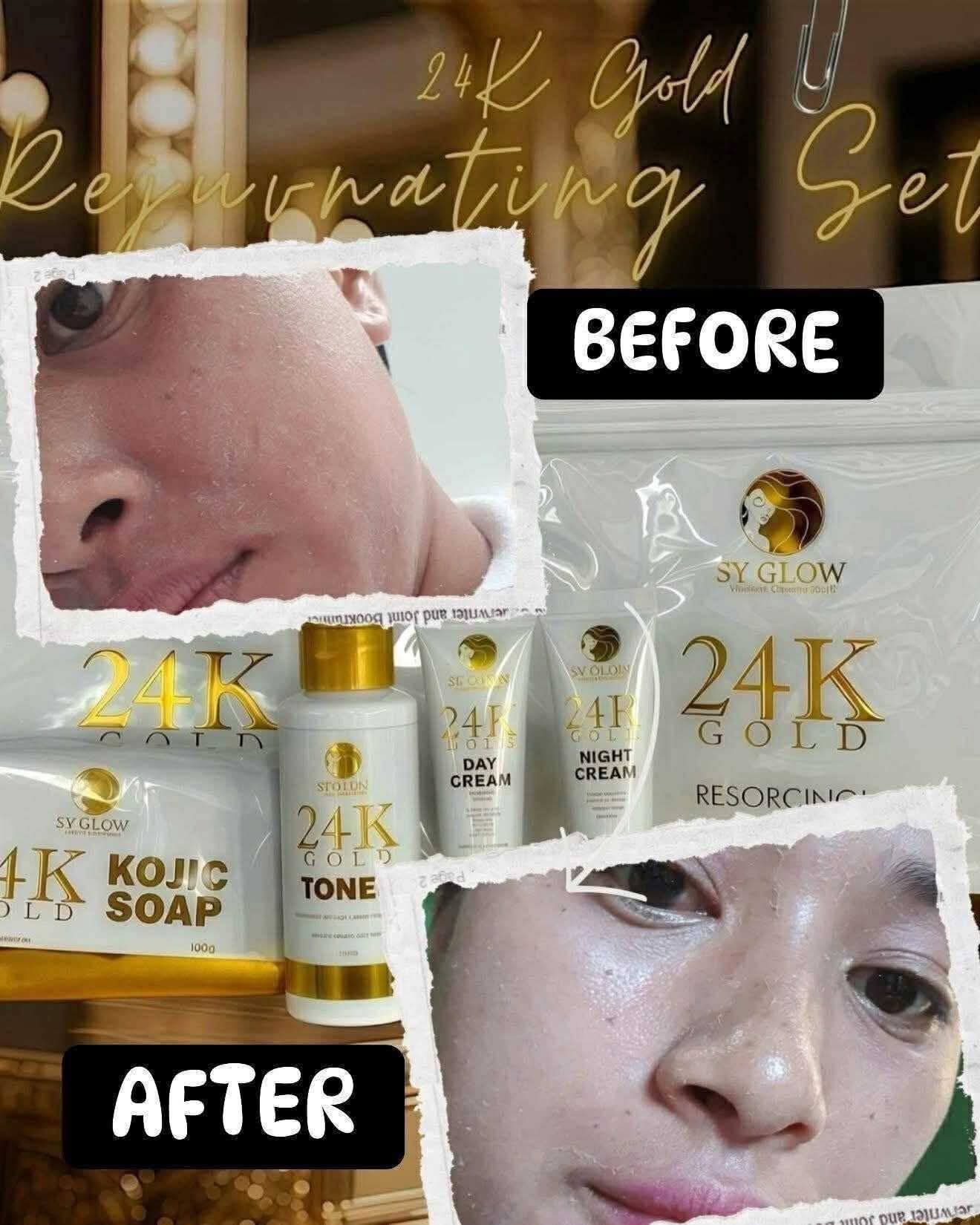 SY GLOW 24K GOLD RESORCINOL REJUVENATING SET