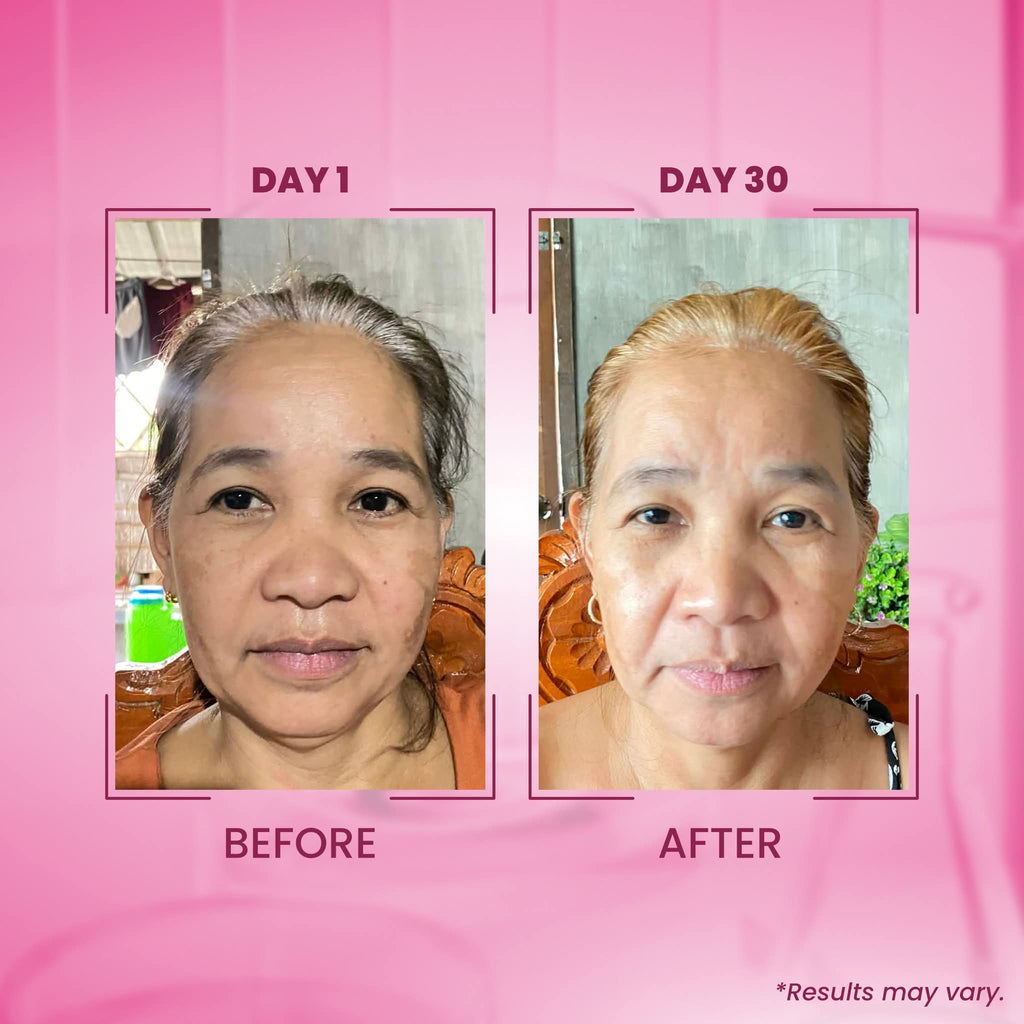Txa melasma clear luxe organic