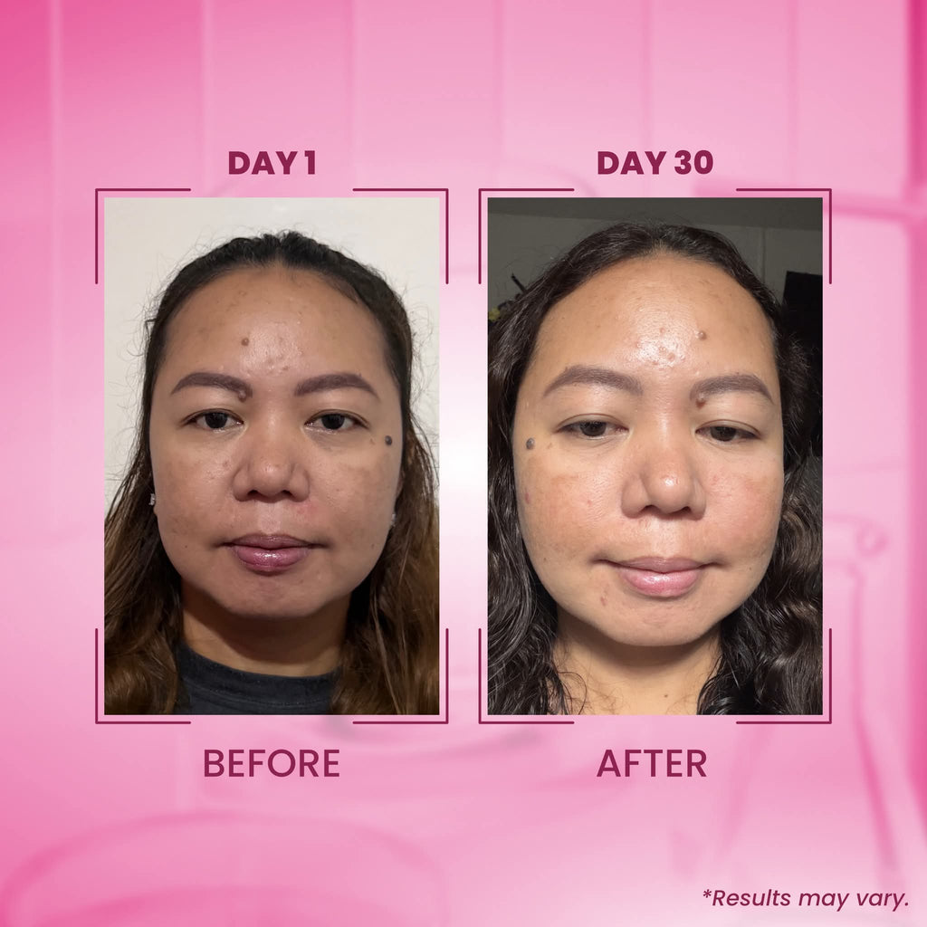 Txa melasma clear luxe organic