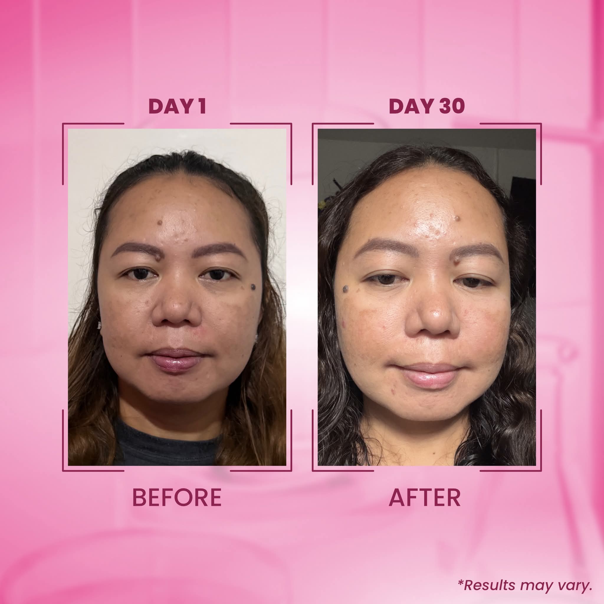 Txa melasma clear luxe organic
